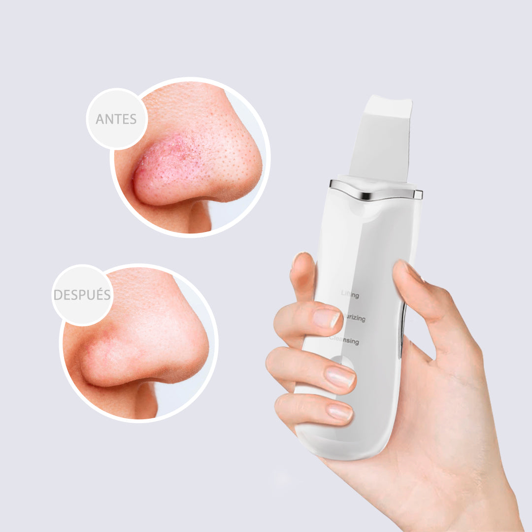 Limpiador Ultrasonico - Cutiscute